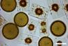 Marine_diatoms.tif