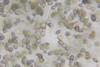 Microscope_view_of_Candida_albicans_20200228_134207_04