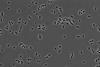 Oral Klebsiella pneumoniae