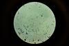 Urine_Sample