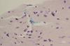 Low-Res_P gingivalis-mouse model-periodontitis and atrial fibrillation connection study