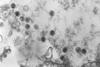 Epstein-Barr-Virus_CDC