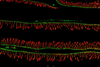 Low-Res_cSI-I-Ecad-Ki67-1