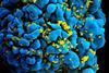 960px-HIV-infected_T_cell_(6813384933) (1)