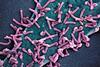 Marburg_virus_outbreak
