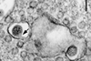 Viruses-11-00477-g004-C