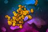 SARS-CoV-2_(yellow)