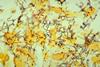 Treponema_pallidum_01