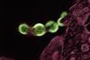 Low-Res_hiv-1-virus-particles-green