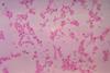 BacteroidesFragilis_Gram