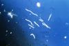 Borrelia_burgdorferi_(CDC-PHIL_-6631)_lores