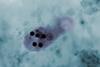 Micrograph_of_Entamoeba_histolytica