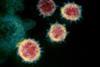 Novel_Coronavirus_SARS-CoV-2 (1)