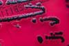 Salmonella_species_growing_on_XLD_agar_-_Showing_H2S_production_-_Detail