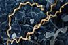 Treponema_pallidum_Bacteria_(Syphilis)