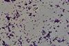 Gram_positive_rods_of_Diphtheroid