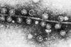 Bacteriophage_Qβ_attached_to_sex_pilus_of_E._coli