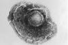 Varicella_(Chickenpox)_Virus_PHIL_1878_lores