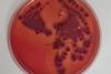 Low-Res_Fang Shigella 2 problematic (1) (1)