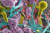 Low-Res_Polymicrobial infection