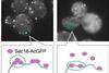 Low-Res_ERES-formation-stress-Sec16-inhibition-Yip3-HQ
