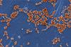 OSC_Microbio_04_04_ArtConn2_img