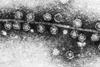 Bacteriophage_Qβ_attached_to_sex_pilus_of_E._coli