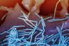 Human_Respiratory_Syncytial_Virus_(RSV)_-_52453988775