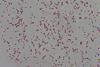 Gram_Negative_bacilli_of_Klebsiella_in_Gram_stained_smear_of_culture