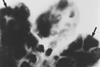 Deer_tick_virus