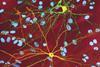 Neuron_with_mHtt_inclusion