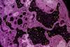 Colorized_transmission_electron_micrograph_of_yellow_fever_virus_particles_(yellow)_found_within_enlarged_cytoplasmic_vesicles_of_a_C6-36_cell_(pink)