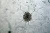 Immagine_di_cellula_di_Glioblastoma_multiforme_della_mia_linea_cellulare_patentata_presso_ECACC_ANGMCSS