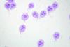 Giardia_trophozoites_Giemsa.tif