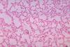 Bacteroides_biacutis_01 (1)