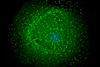 960px-HIV_on_macrophage