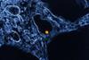 West_Nile_Virus_-_53865578133 (1)
