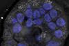 Low-Res_Microscope image of a lab-grown mini-lung showing flu virus particles (in blue) spreading across tissue