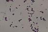 Streptococcus_agalactiae_Gram_staining_of_culture