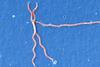 Lyme_disease_parasite_Borrelia_burgdorferi