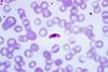 Plasmodium falciparum macrogametocyte