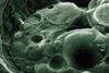 CSIRO_ScienceImage_1168_Scanning_Electron_Micrograph_of_Chytrid_Fungus