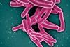 Mycobacterium_Tuberculosis_Bacteria,_the_Cause_of_TB_(52766234986)