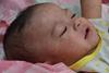 Measles_child_Philippines