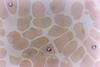 Plasmodium_falciparum_in_Red_Blood_Cells