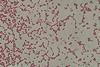 Gram_-negative_cocci_(GNC)_and_Gram_-negative_rod_(GNR)_of_Acinetobactet_baumannii_in_Gram_staining