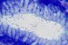Helicobacter_pylori_in_a_case_of_gastritis (1)