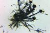 Microscope_view_of_Aspergillus_flavus_fungus_14