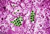 Dengue_Virus_Particles_(53231916461)