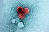 Epstein-Barr_Virus_(EBV)_Particles_-_53583885254